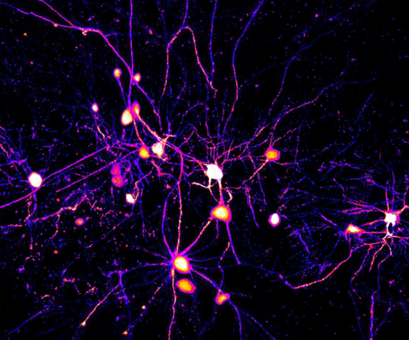 접근방식 이미지