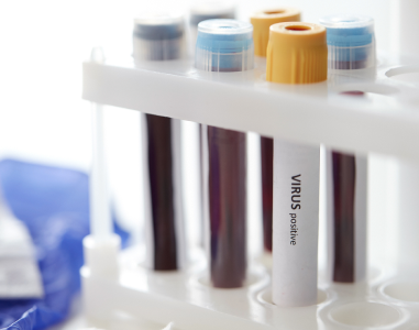 17종 혈액 검사기